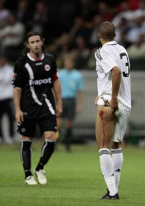 Fussball, Testspiel, Eintracht Frankfurt vs. Real Madrid Fussball, Testspiel, Eintracht Frankfurt vs. Real Madrid, Ioannis Amanatidis (F, li), Pepe (M, re) mit Fleischwunde am Oberschenkel.
