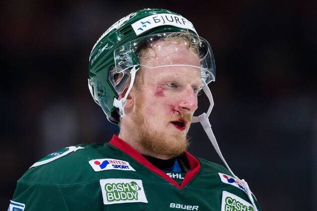 180130 Frölunda s Simon hjalmarsson leaving the ice with damage in the face during the ice hockey match in the SHL between Frölunda and Animal garden on 30 January 2018 in Gothenburg  Copyright: MICHAELxERICHSEN BB180130MI058