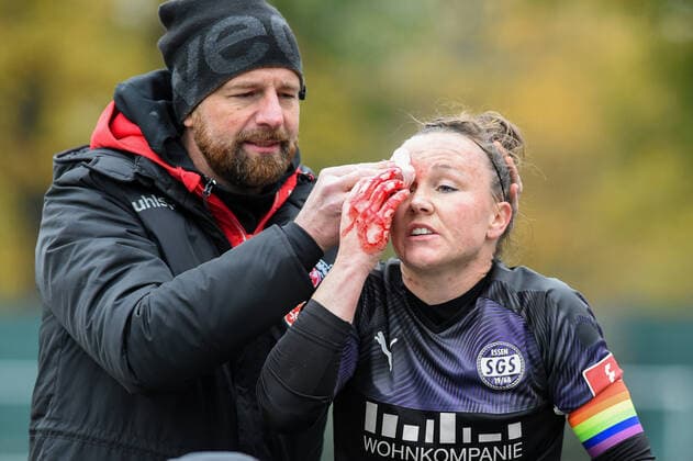 Marina Hegering SGS, 27 injured after a collision with Eunice Beckmann Cologne, 11 not in picture, not picturedmit pain, racked with pain, 17 11 2019, Cologne Germany , Football, DFB Cup Women, Round of 16, 1 FC Cologne SGS Essen, DFB DFL REGULATIONS PROHIBIT ANY USE OF PHOTOGRAPHS AS IMAGE SEQUENCES AND OR QUASI VIDEO xmhx