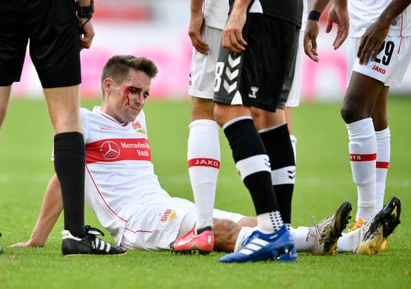 Philipp Klement VfB Stuttgart injured Injury Head injury Head wound blood VfB Stuttgart vs SC Freiburg SCF 19 09 2020 DFL REGULATIONS PROHIBIT ANY USE OF PHOTOGRAPHS AS IMAGE SEQUENCES AND OR QUASI VIDEO VfB Stuttgart vs SC Freiburg