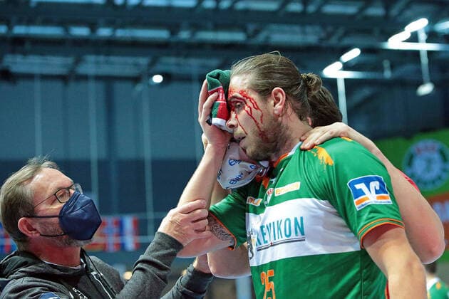 18 02 2021, xovx, Handball 1 Bundesliga, HSG Wetzlar TSV Hannover Burgdorf v l Olle Forsell Schefvert HSG Wetzlar badly injured in the face emspor Wetzlar