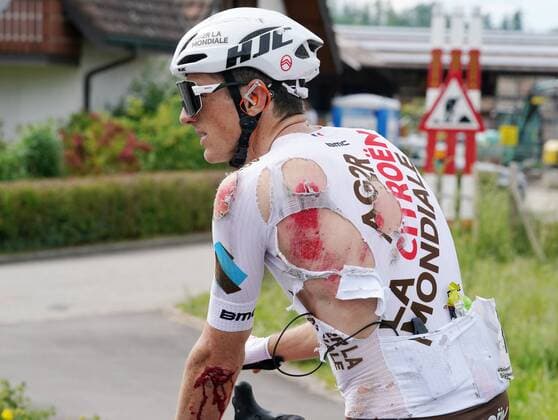 Photo Manuel Geisser 04 06 2021 Cycling Grand Prix of the Canton of Aargau Gippingen Picture Crash Victim Mathias Frank SUI Team AG2R Citroen Action