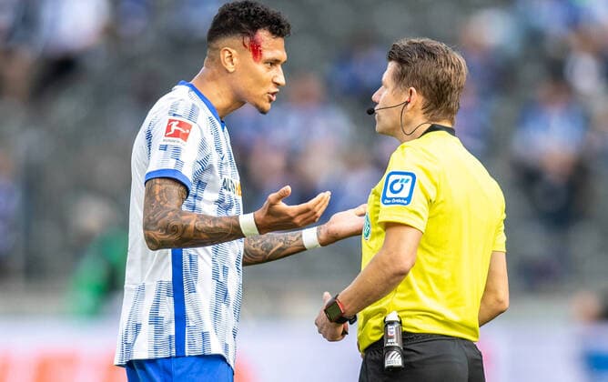 Berlin, 02 10 2021, Football, Bundesliga, Matchday 7, Hertha BSC SC Freiburg, Olympiastadion Berlins Davie Selke has bleeding head wound and talks to referee Patrick Ittrich r DFL regulations and DFB regulations prohibit any use of photographs as image sequences and or quasi video, Foto Andreas Gora Hertha BSC SC Freiburg