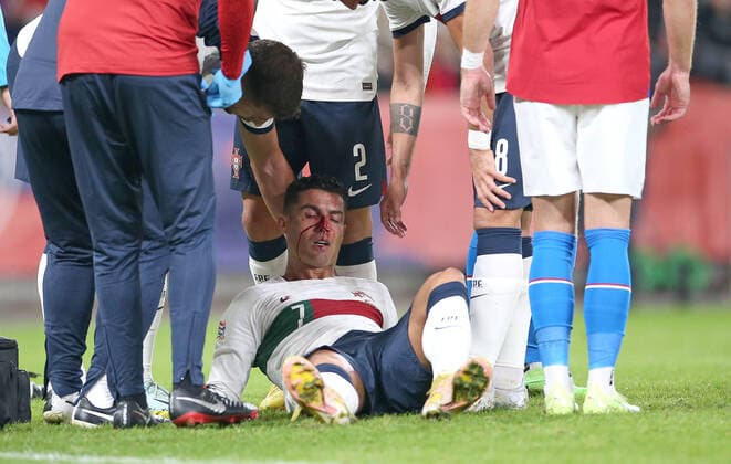 24 09 2022, football international match UEFA Nations League 2022 23, Czech Republic Portugal, at Fortuna Arena Prague Cristiano Ronaldo Portugal injured after collision and requires treatment