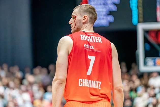 Chemnitz, Germany 03 October 2024 1 BBL 2024 2025 Niners Chemnitz vs BG Göttingen In the picture Jonas Richter Chemnitz injured on the head with bleeding Copyright: xFotostandx xNachtigallx