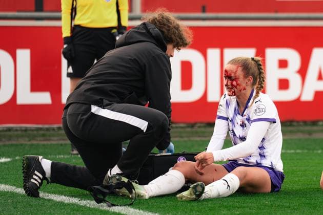 Paula Flach (SGS Essen, 5) getting injured during the Google Pixel Frauen Bundesliga game between Bayer 04 Leverkusen and SGS Essen at Ulrich - Haberland Stadium in Levekusen, Germany Copyright: xLeoniexKiehlx xSPPx Sportspressphoto_SPR64667
