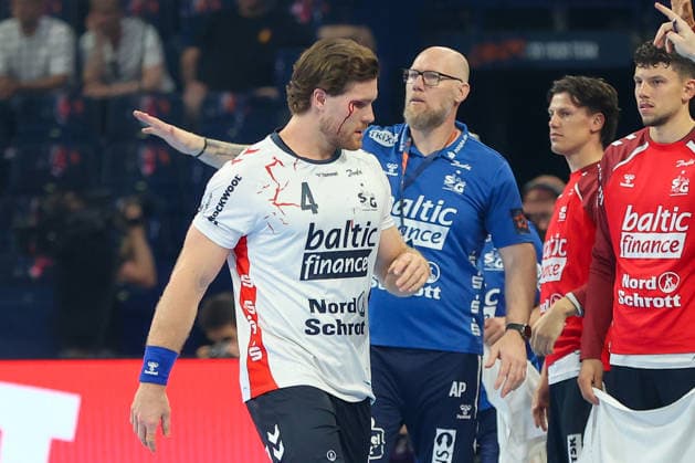 30 05 2026, xgox, Handball EHF European League semi-final MT Melsungen SG Flensburg Handewitt v l Johannes Golla Flensburg, 4 bleeding from eye, injury, injured Hamburg