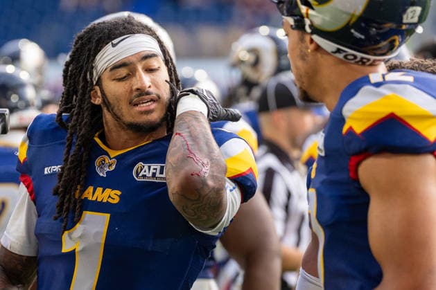 Cameron Bergeron, Alpine Rams, 01, bleeding from the arm, GER Rhein Fire vs. Alpine Rams, American Football, AFLE, 2026 Season, August 1, 2026, GER Rhein Fire vs. Alpine Rams, American Football, AFLE, 2026 Season, August 1, 2026, Duisburg Copyright: xEibner-Pressefoto FabianxFriesex EP_FFE