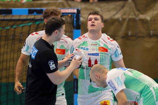 August 7, 2026, xtgx, Handball Tournament, EHV Aue vs. SC Magdeburg emspor, from left: Elvar Orn Jonsson (Magdeburg), 19 injured, injury, Auge Lößnitz