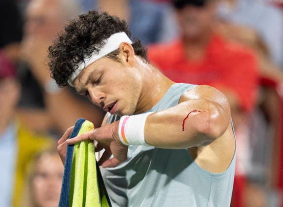 August 12, 2026, Montreal, Pq, Canada: Ben Shelton of the United States calls for a medical time out during his match against compatriot Learner Tien during semifinal tennis action at the National Bank Open in Montreal on Wednesday, Aug. 12, 2026. Canada News - August 12, 2026  - ZUMAc35_ 20260812_zaf_c35_104 Copyright: xChristinnexMuschix