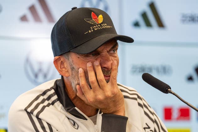September 17, 2026, GER, UEFA Nations League 2026–2027 Nomination Press Conference with National Team Coach Jürgen Klopp; Jürgen Klopp, National Team Coach, Head Coach, Germany; hands in front of his face, annoyed, gestures, facial expressions, emotions; Frankfurt, DFB Campus, Frankfurt, Germany Copyright: xnordphotoxGmbHx xChristianxSchulzex