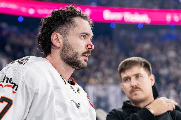Matthew Wedman, Löwen Frankfurt, 67, with a small cut on his nose; portrait; GER; EHC Red Bull Munich vs. Löwen Frankfurt; ice hockey; DEL; 2026–2027 season; Matchday 4, September 27, 2026 Photo: HMB Media, Heike Feiner Copyright: HMBxMedia HeikexFeiner