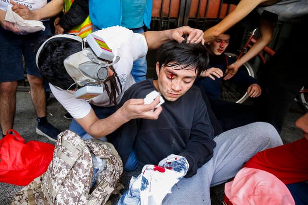 Concepcion, 21 October 2019 Students injured after facing Carabineros Special Forces on third day of social discontent protests in Concepcion Esteban Paredes Aton Chile, Aton 361579  Copyright: ESTEBANxPAREDES ATONxCHILE