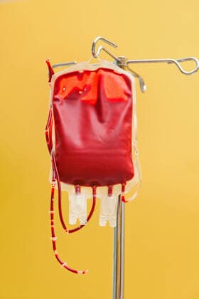 A unit of blood for infusion into a clinic Donor blood is administered McPBBO McPBBO