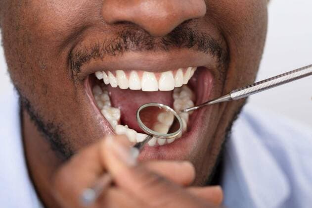 Male Patient Being Checked By Dentist model released, Symbolfoto, 13.10.2020, Copyright: xAndreyPopovx Panthermedia26328711