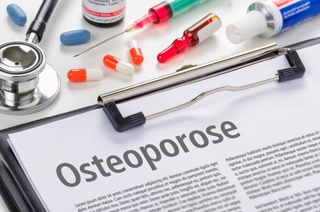 osteoporosis,bone atrophy puo-h1i