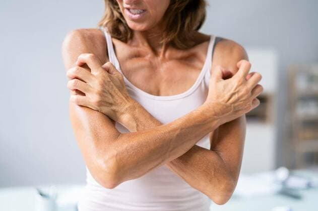 Woman With Itchy Skin, Woman With Itchy Skin. Allergy Or Psoriasis, Woman With Itchy Skin. Allergy Or Psoriasis model released, Symbolfoto , 08.07.2022, Copyright: xAndreyPopovx Panthermedia31603601.jpg