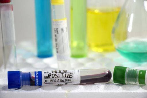 RECORD DATE NOT STATED A closeup shot of HIV positive blood specimen on a test tube in the laboratory *** einer closeupe erschossen des HIV positiv Blut specimen am einer testen Röhre ÊIn der Labor 1603055
