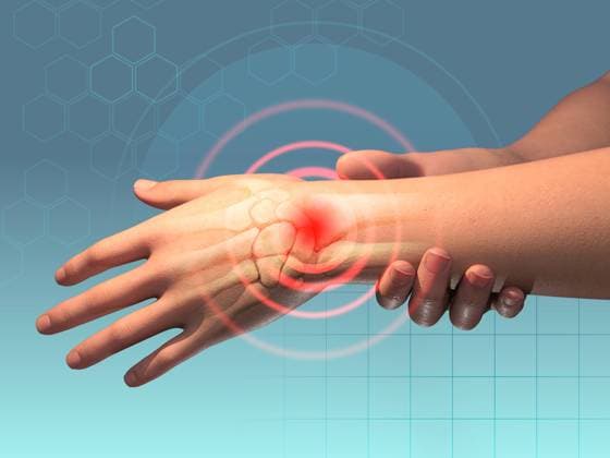 Wrist pain symptoms Wrist pain caused by traumas or other health issues. Digital illustration, 3D render. Copyright: xZoonar.com AndreaxDantix 21477292
