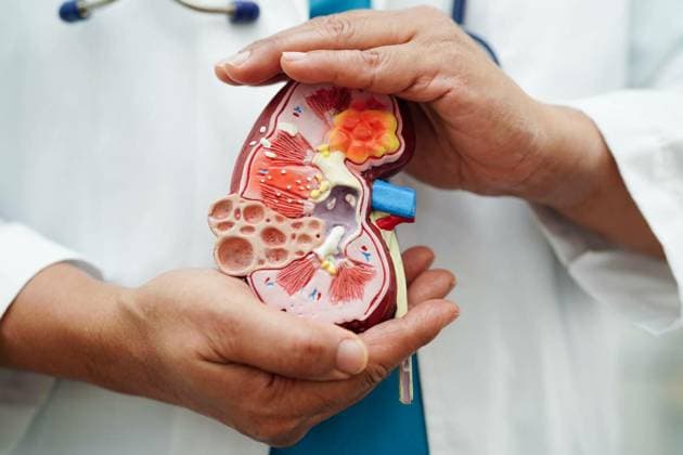 Chronic kidney disease, doctor holding model for treatment urina, Chronic kidney disease, doctor holding model for treatment urinary system, urology, Estimated glomerular filtration rate eGFR., Chronic kidney disease, doctor holding model for treatment urinary system, urology, Estimated glomerular filtration rate eGFR., 20.10.2023, Copyright: xsweettomatox Panthermedia36052592.jpg