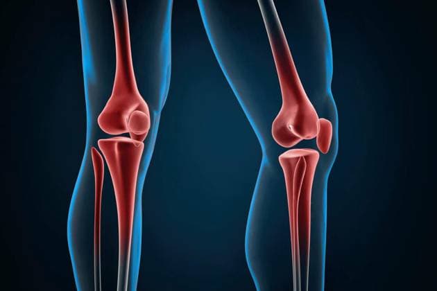 Injured knees close-up. 3D illustration, Injured knees close-up. 3D illustration., Injured knees close-up. 3D illustration., 12.09.2024, Copyright: xKirillx Panthermedia37887511.jpg