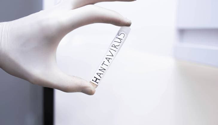 Eine behandschuhte Hand, die ein Hantavirus Teströhrchen in einer sterilen Laborumgebung hält A gloved hand holding a Hantavirus test tube in a sterile lab setting Copyright: imageBROKER MikalaixSayevich ibxwsp12339840.jpg