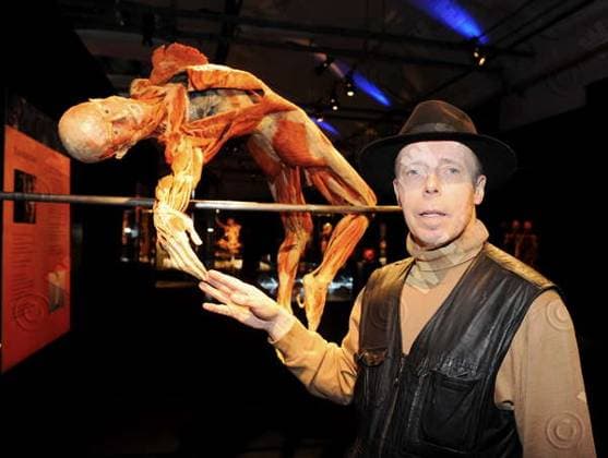 Gunther von Hagens at a photocall for his new KÂörperwelten exhibition at Postbahnhof , Berlin, Berlin, Germany WENN 2408410.jpg
