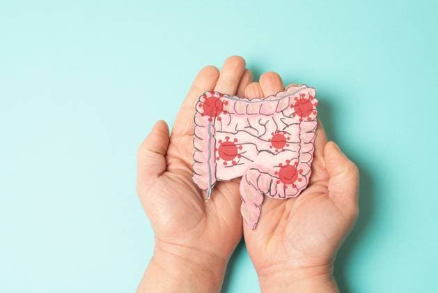 Colon, Digestive system with EHEC bacterial Disease, Enterohemorrhagic Escherichia coli, shigatoxigene and verotoxigene, Blutiger Diarrhea, food-borne Disease, the Gut infizierend 1133603075
