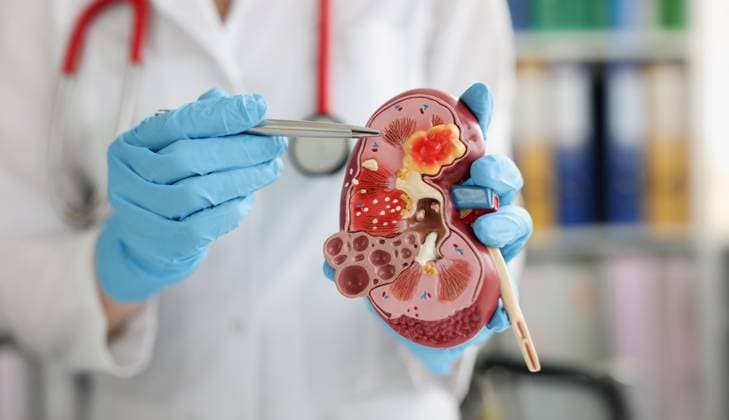 Urologist pointing pen kidney structure on anatomical model Close-up of urologist pointing pen kidney structure on anatomical model. Treatment of kidney diseases, pyelonephritis, 60978654.jpg RECORD DATE NOT STATED