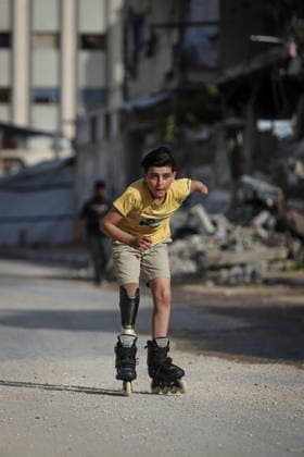 Gaza child who lost limbs in Israeli attacks holds onto life with skating GAZA CITY, GAZA, PALESTINE - MAY 12: Thirteen-year-old Akram al-Fayyumi, who lost his left arm and right foot in an Israeli attack on Gaza, skates on the streets of Gaza City, Gaza, Palestine on May 12, 2026. Akram is holding on to life through his passion for skating and horse riding. Despite using a prosthetic leg fitted in Egypt that he finds uncomfortable, he continues to skate. His only dream is to have a new prosthesis and a horse. Living in the Tel al-Hawa area of Gaza City, Akram says that skating is his greatest source of happiness. Saeed M. M. T. Jaras Anadolu Gaza City Gaza. Editorial use only. Please get in touch for any other usage.  Copyright: x2026xAnadoluxSaeedxM.xM.xT.xJarasx