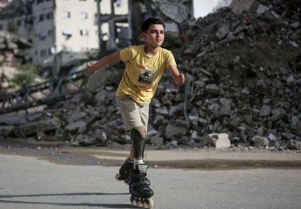 Gaza child who lost limbs in Israeli attacks holds onto life with skating GAZA CITY, GAZA, PALESTINE - MAY 12: Thirteen-year-old Akram al-Fayyumi, who lost his left arm and right foot in an Israeli attack on Gaza, skates on the streets of Gaza City, Gaza, Palestine on May 12, 2026. Akram is holding on to life through his passion for skating and horse riding. Despite using a prosthetic leg fitted in Egypt that he finds uncomfortable, he continues to skate. His only dream is to have a new prosthesis and a horse. Living in the Tel al-Hawa area of Gaza City, Akram says that skating is his greatest source of happiness. Saeed M. M. T. Jaras Anadolu Gaza City Gaza. Editorial use only. Please get in touch for any other usage.  Copyright: x2026xAnadoluxSaeedxM.xM.xT.xJarasx