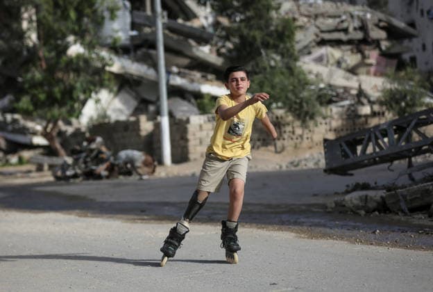 Gaza child who lost limbs in Israeli attacks holds onto life with skating GAZA CITY, GAZA, PALESTINE - MAY 12: Thirteen-year-old Akram al-Fayyumi, who lost his left arm and right foot in an Israeli attack on Gaza, skates on the streets of Gaza City, Gaza, Palestine on May 12, 2026. Akram is holding on to life through his passion for skating and horse riding. Despite using a prosthetic leg fitted in Egypt that he finds uncomfortable, he continues to skate. His only dream is to have a new prosthesis and a horse. Living in the Tel al-Hawa area of Gaza City, Akram says that skating is his greatest source of happiness. Saeed M. M. T. Jaras Anadolu Gaza City Gaza. Editorial use only. Please get in touch for any other usage.  Copyright: x2026xAnadoluxSaeedxM.xM.xT.xJarasx
