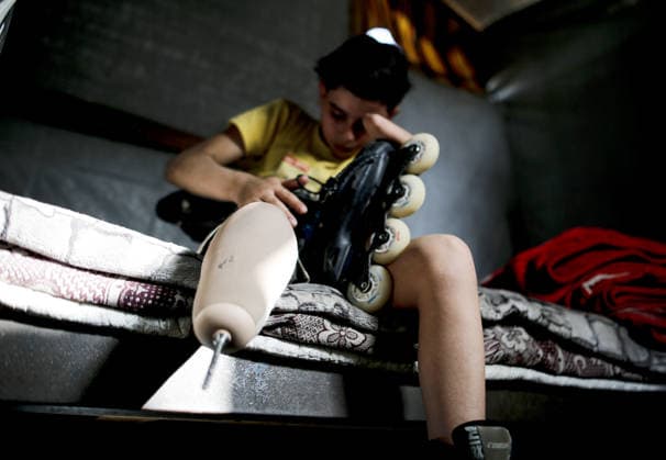 Gaza child who lost limbs in Israeli attacks holds onto life with skating GAZA CITY, GAZA, PALESTINE - MAY 12: Thirteen-year-old Akram al-Fayyumi, who lost his left arm and right foot in an Israeli attack on Gaza, is seen with his skates at his home Gaza City, Gaza, Palestine on May 12, 2026. Akram is holding on to life through his passion for skating and horse riding. Despite using a prosthetic leg fitted in Egypt that he finds uncomfortable, he continues to skate. His only dream is to have a new prosthesis and a horse. Living in the Tel al-Hawa area of Gaza City, Akram says that skating is his greatest source of happiness. Saeed M. M. T. Jaras Anadolu Gaza City Gaza. Editorial use only. Please get in touch for any other usage.  Copyright: x2026xAnadoluxSaeedxM.xM.xT.xJarasx