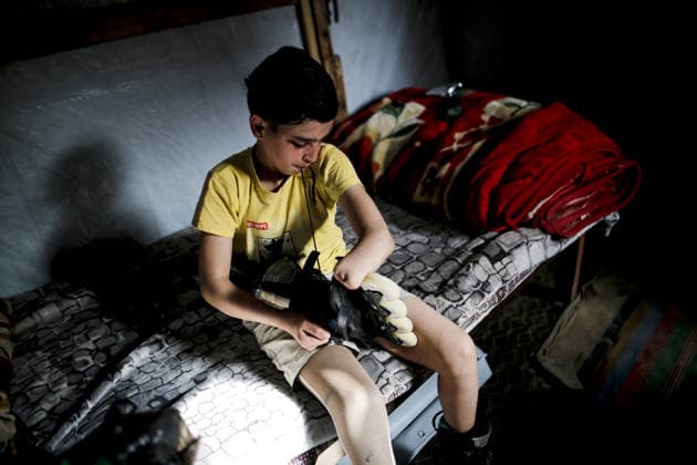 Gaza child who lost limbs in Israeli attacks holds onto life with skating GAZA CITY, GAZA, PALESTINE - MAY 12: Thirteen-year-old Akram al-Fayyumi, who lost his left arm and right foot in an Israeli attack on Gaza, is seen with his skates at his home Gaza City, Gaza, Palestine on May 12, 2026. Akram is holding on to life through his passion for skating and horse riding. Despite using a prosthetic leg fitted in Egypt that he finds uncomfortable, he continues to skate. His only dream is to have a new prosthesis and a horse. Living in the Tel al-Hawa area of Gaza City, Akram says that skating is his greatest source of happiness. Saeed M. M. T. Jaras Anadolu Gaza City Gaza. Editorial use only. Please get in touch for any other usage.  Copyright: x2026xAnadoluxSaeedxM.xM.xT.xJarasx