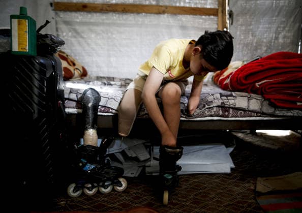 Gaza child who lost limbs in Israeli attacks holds onto life with skating GAZA CITY, GAZA, PALESTINE - MAY 12: Thirteen-year-old Akram al-Fayyumi, who lost his left arm and right foot in an Israeli attack on Gaza, is seen with his skates at his home Gaza City, Gaza, Palestine on May 12, 2026. Akram is holding on to life through his passion for skating and horse riding. Despite using a prosthetic leg fitted in Egypt that he finds uncomfortable, he continues to skate. His only dream is to have a new prosthesis and a horse. Living in the Tel al-Hawa area of Gaza City, Akram says that skating is his greatest source of happiness. Saeed M. M. T. Jaras Anadolu Gaza City Gaza. Editorial use only. Please get in touch for any other usage.  Copyright: x2026xAnadoluxSaeedxM.xM.xT.xJarasx