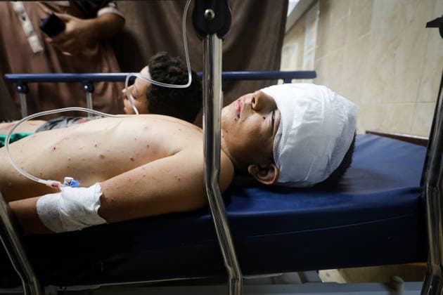 Israeli attacks continue on Gaza DEIR AL-BALAH, GAZA, PALESTINE - SEPTEMBER 16 : (EDITORS NOTE: Image depicts graphic content) An injured Palestinian child receives medical treatment at Al-Awda Hospital after an Israeli attack targeted a group of Palestinians waiting to collect water at the Bureij Refugee Camp in the central Gaza Strip, in Deir al-Balah, Gaza, Palestine on September 16, 2026. Moiz Salhi Anadolu Deir Al Balah Gaza. Editorial use only. Please get in touch for any other usage.  Copyright: x2026xAnadoluxMoizxSalhix