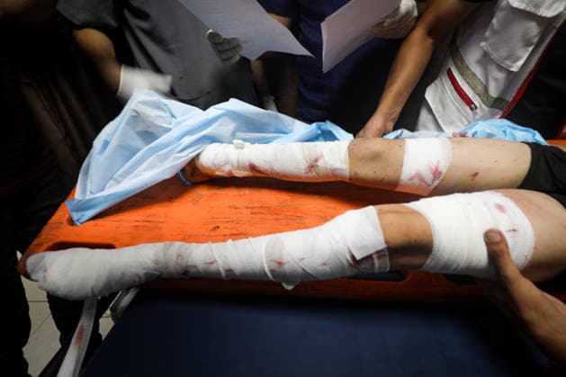 Israeli attacks continue on Gaza DEIR AL-BALAH, GAZA, PALESTINE - SEPTEMBER 16 : (EDITORS NOTE: Image depicts graphic content) An injured Palestinian child receives medical treatment at Al-Awda Hospital after an Israeli attack targeted a group of Palestinians waiting to collect water at the Bureij Refugee Camp in the central Gaza Strip, in Deir al-Balah, Gaza, Palestine on September 16, 2026. Moiz Salhi Anadolu Deir Al Balah Gaza. Editorial use only. Please get in touch for any other usage.  Copyright: x2026xAnadoluxMoizxSalhix