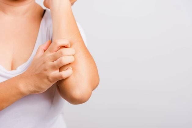 Asian beautiful woman itching her useing hand scratch itch Arm on white background with copy space, Medical and Healthcare concept Copyright: xSorapopx Panthermedia79215532.jpg