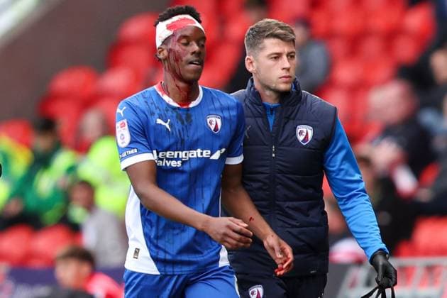 Bilder des Jahres 2024, Sport 09 September Sport Themen der Woche KW39 Sport Bilder des Tages Harvey Araujo of Chesterfield leaves the pitch covered in blood after a head injury Doncaster Rovers v Chesterfield, EFL Sky Bet League Two, Football, Eco-Power Stadium, Doncaster, UK, 28 Sep 2024 EDITORIAL USE ONLY No use with unauthorised audio, video, data, fixture lists, club league logos or live services. Online in-match use limited to 120 images, no video emulation. No use in betting, games or single club league player publications. Copyright: xJakexKirkman Shutterstockx 14741410eg