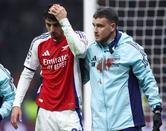 Bilder des Jahres 2024, Sport 11 November Sport Themen der Woche KW45 Sport Bilder des Tages Kai Havertz of Arsenal sustains a bloody head injury Inter Milan v Arsenal, UEFA Champions League, Group Stage, Football, San Siro Stadium, Milan, Italy - 06 Nov 2024 EDITORIAL USE ONLY No use with unauthorised audio, video, data, fixture lists, club league logos or live services. Online in-match use limited to 120 images, no video emulation. No use in betting, games or single club league player publications. Copyright: xMarcoxCanienero Shutterstockx 14863816bj