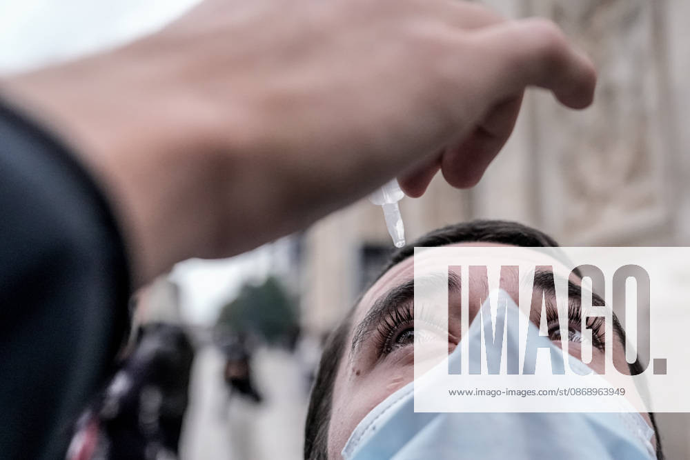 Police clash with students during education protest in Nancy NANCY, FRANCE - OCTOBER 8: A man receives eye drops to relief tear gas effect during student protest against education conditions in Nancy, France on October 8, 2026. Students took part in a nationwide high-school mobilization over school conditions and demands for greater education resources. Muhammed Said Tako Anadolu Nancy France. Editorial use only. Please get in touch for any other usage.