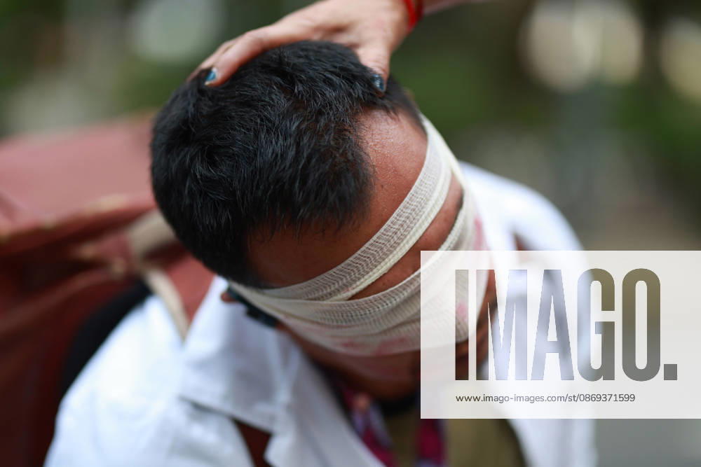 Thousands of healthcare workers hold national protest in Mexico City MEXICO CITY, MEXICO - OCTOBER 13: A man takes part in a street performance during a national protest march demanding wage increases for healthcare workers and more medical supplies for Mexico s public health system, in Mexico City, Mexico on October 13, 2026. Thousands of members of the Mexican Social Security Institute (IMSS) marched to demand higher wages, improved working conditions, and action to address nationwide shortages of basic medicines and supplies across public hospitals. Daniel Cardenas Anadolu Mexico City Mexico. Editorial use only. Please get in touch for any other usage.