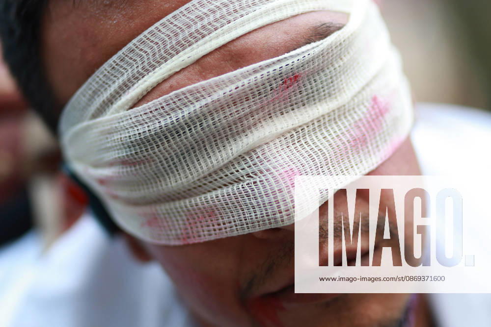 Thousands of healthcare workers hold national protest in Mexico City MEXICO CITY, MEXICO - OCTOBER 13: A man takes part in a street performance during a national protest march demanding wage increases for healthcare workers and more medical supplies for Mexico s public health system, in Mexico City, Mexico on October 13, 2026. Thousands of members of the Mexican Social Security Institute (IMSS) marched to demand higher wages, improved working conditions, and action to address nationwide shortages of basic medicines and supplies across public hospitals. Daniel Cardenas Anadolu Mexico City Mexico. Editorial use only. Please get in touch for any other usage.
