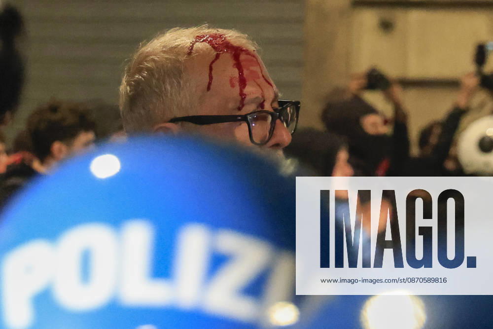 Demonstration against the Italian government in Rome ROME, ITALY, OCTOBER 24: (EDITOR S NOTE: Image depicts graphic content) A protester is seen after been wounded during clashes between Italian police and demonstrators against the Italian government in Rome, Italy, on October 24, 2026. Riccardo De Luca Anadolu Rome Italy. Editorial use only. Please get in touch for any other usage.