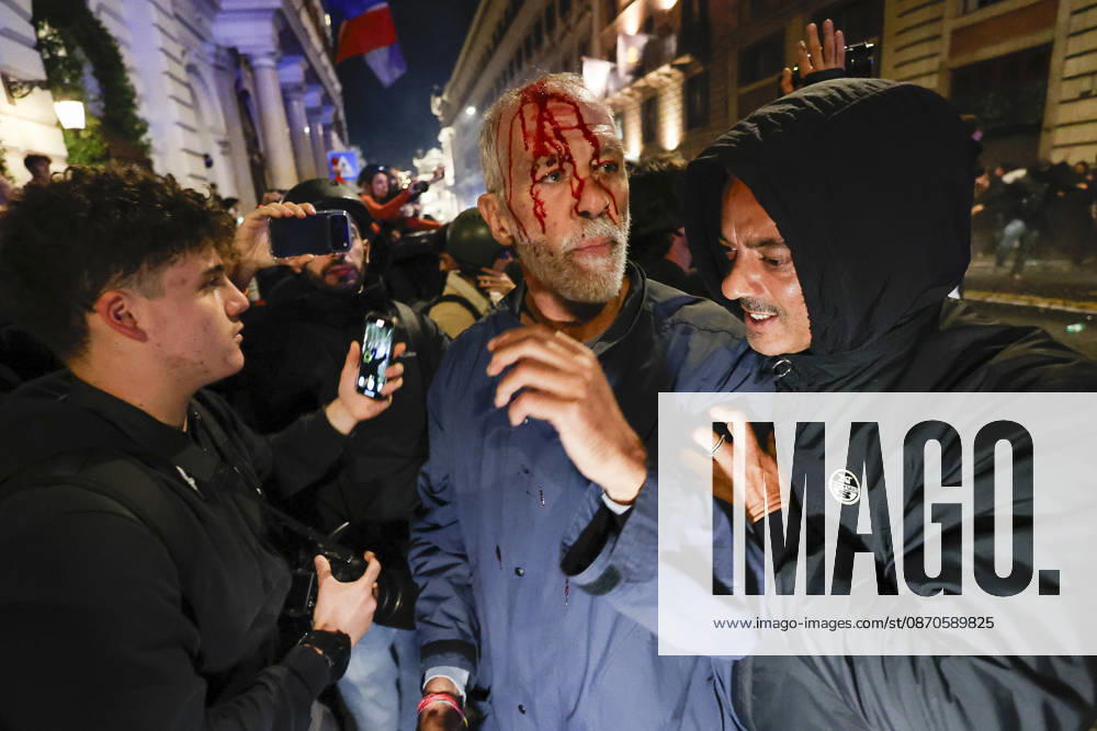 Demonstration against the Italian government in Rome ROME, ITALY, OCTOBER 24: (EDITOR S NOTE: Image depicts graphic content) A protester is seen after been wounded during clashes between Italian police and demonstrators against the Italian government in Rome, Italy, on October 24, 2026. Riccardo De Luca Anadolu Rome Italy. Editorial use only. Please get in touch for any other usage.