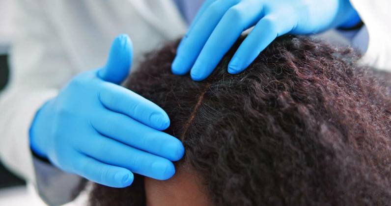 Dermatologist Checking Patient s, Dermatologist Checking Patient s Hair. Hairloss And Psoriasis Check, Dermatologist Checking Patient s Hair. Hairloss And Psoriasis Check model released, Symbolfoto , 17.02.2023, Copyright: xAndreyPopovx Panthermedia33650034.jpg