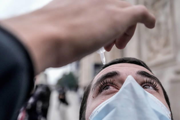 Police clash with students during education protest in Nancy NANCY, FRANCE - OCTOBER 8: A man receives eye drops to relief tear gas effect during student protest against education conditions in Nancy, France on October 8, 2026. Students took part in a nationwide high-school mobilization over school conditions and demands for greater education resources. Muhammed Said Tako Anadolu Nancy France. Editorial use only. Please get in touch for any other usage.  Copyright: x2026xAnadoluxMuhammedxSaidxTakox