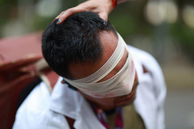 Thousands of healthcare workers hold national protest in Mexico City MEXICO CITY, MEXICO - OCTOBER 13: A man takes part in a street performance during a national protest march demanding wage increases for healthcare workers and more medical supplies for Mexico s public health system, in Mexico City, Mexico on October 13, 2026. Thousands of members of the Mexican Social Security Institute (IMSS) marched to demand higher wages, improved working conditions, and action to address nationwide shortages of basic medicines and supplies across public hospitals. Daniel Cardenas Anadolu Mexico City Mexico. Editorial use only. Please get in touch for any other usage.  Copyright: x2026xAnadoluxDanielxCardenasx