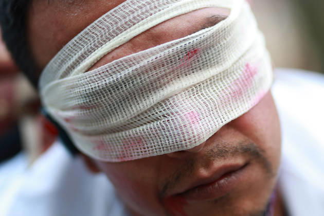 Thousands of healthcare workers hold national protest in Mexico City MEXICO CITY, MEXICO - OCTOBER 13: A man takes part in a street performance during a national protest march demanding wage increases for healthcare workers and more medical supplies for Mexico s public health system, in Mexico City, Mexico on October 13, 2026. Thousands of members of the Mexican Social Security Institute (IMSS) marched to demand higher wages, improved working conditions, and action to address nationwide shortages of basic medicines and supplies across public hospitals. Daniel Cardenas Anadolu Mexico City Mexico. Editorial use only. Please get in touch for any other usage.  Copyright: x2026xAnadoluxDanielxCardenasx
