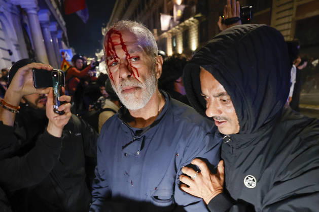Demonstration against the Italian government in Rome ROME, ITALY, OCTOBER 24: (EDITOR S NOTE: Image depicts graphic content) A protester is seen after been wounded during clashes between Italian police and demonstrators against the Italian government in Rome, Italy, on October 24, 2026. Riccardo De Luca Anadolu Rome Italy. Editorial use only. Please get in touch for any other usage.  Copyright: x2026xAnadoluxRiccardoxDexLucax